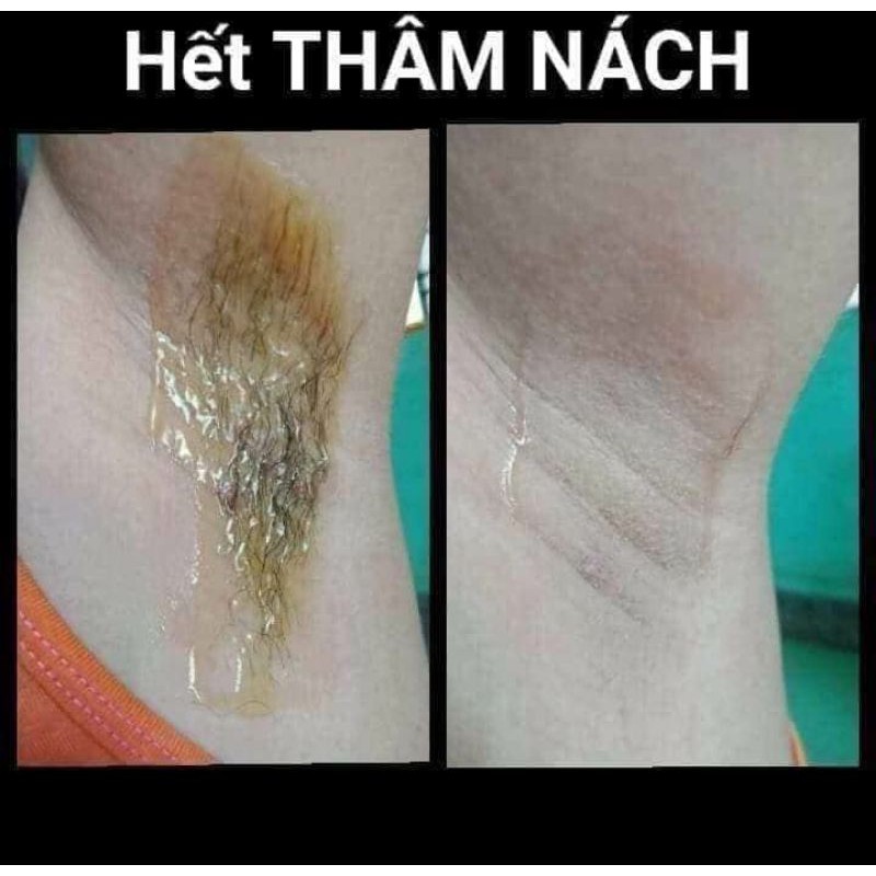 Wax Lông An Lành Tặng 50 tờ giấy và 2 que wax | BigBuy360 - bigbuy360.vn