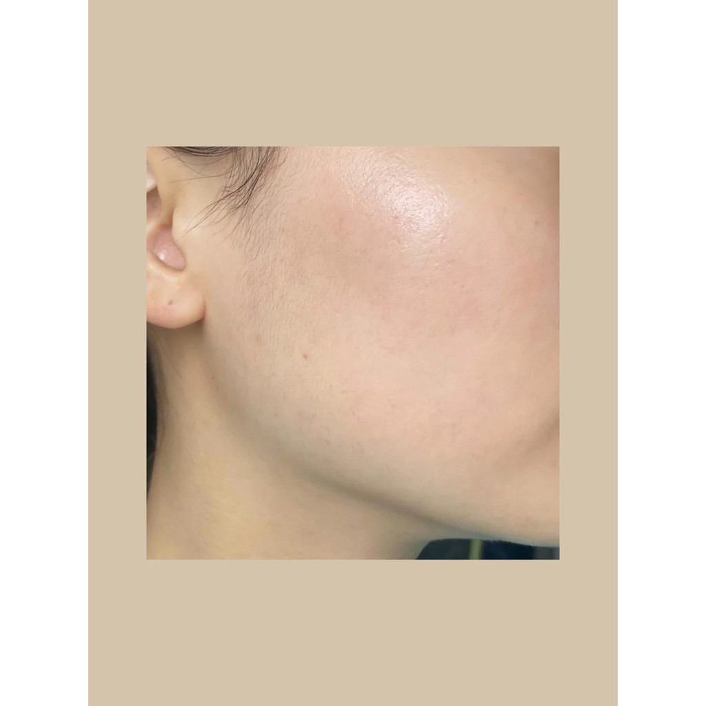 Serum cấp nước, giảm thâm và chống lão hoá Skin Deva HA + Vit C 30ml