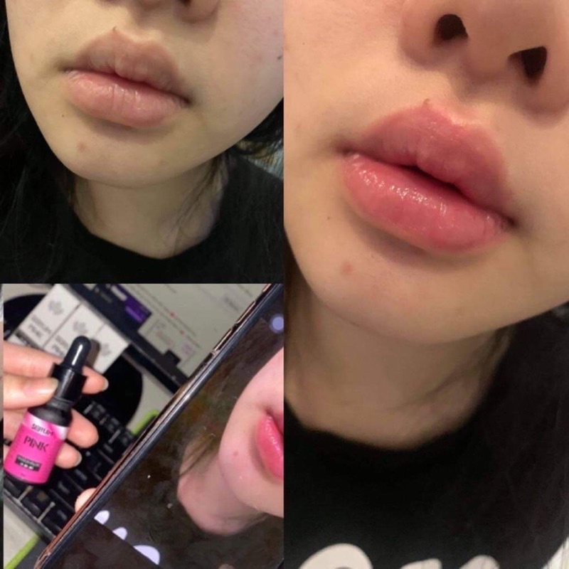 Serum Pink - -Tinh Chất Làm hồng 3in1