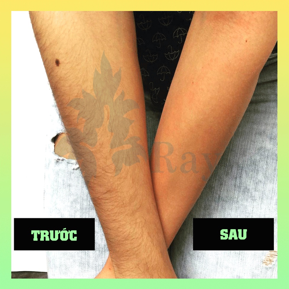 Sáp Wax Lông Hạt Đậu Hard Bean 100g - Wax tẩy lông nách, bikini, vùng kín an toàn, tiết kiệm