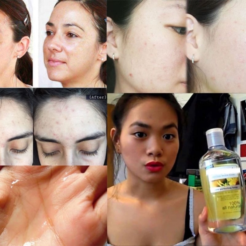 Nước hoa hồng DICKINSON PORE PERFECTING 473ML