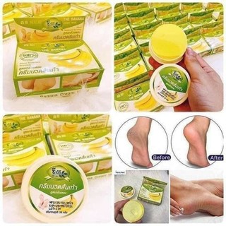 Kem trị nứt gót chân chuối Thái