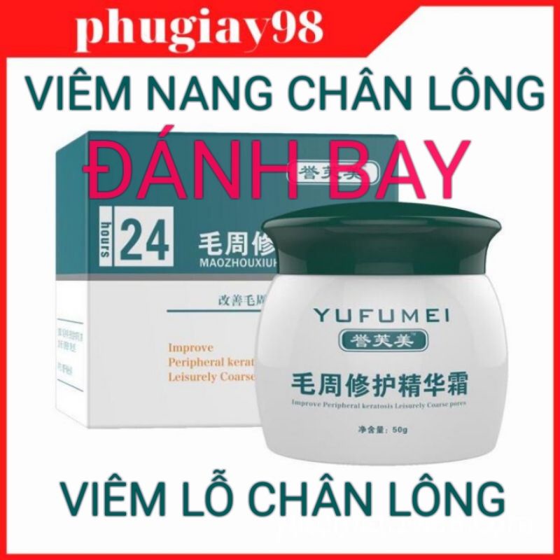 ❤️Đánh bay viêm nang lông , viêm lỗ chân lông chân , da gà , da rắn vảy cá ở chân ( sẵn hàng) hot