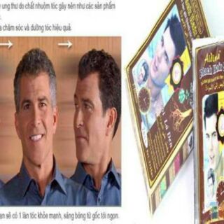 Dầu Gội Đen Tóc Black Hair Fast Magic Thái Lan