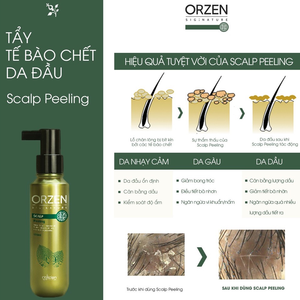 Tẩy Tế Bào Chết Cho Da ĐẦU Orzen Scalp Peeling hỗ trợ ngăn rụng tóc, kích thích mọc tóc, làm sạch gàu hiệu quả 120ml