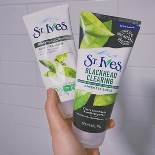 Sữa Rửa Mặt Sạch Mụn Đầu Đen St.Ives Trà Xanh (170g)