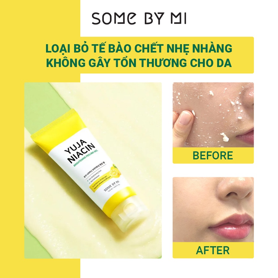 [Mã BMTTC60K giảm đến 60K đơn 50K] Gel Tẩy Da Chết, Dưỡng Trắng Da Some By Mi Yuja Niacin Brightening Peeling Gel 120ml