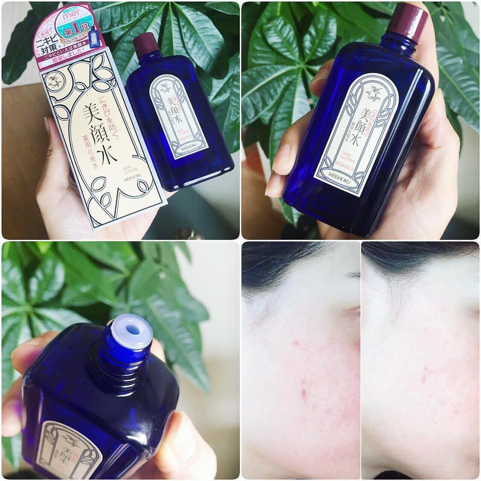 [ Chất Lượng ] Nước hoa hồng mụn Bigansui đặc biệt | BigBuy360 - bigbuy360.vn