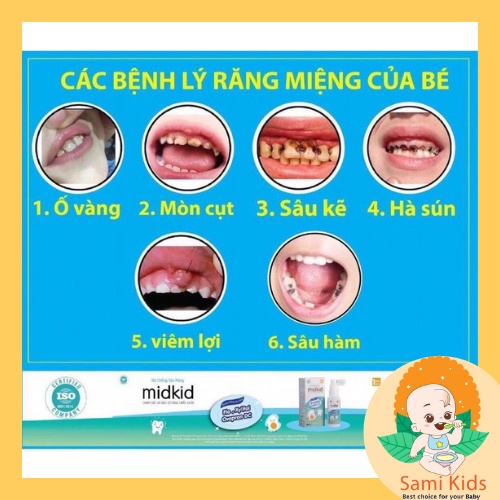 Xịt chống sâu răng cho bé Midkid, xịt răng miệng bảo vệ men răng, ngăn ngừa ố vàng, hà mủn SAMI KIDS