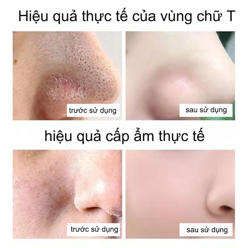 Mặt Nạ Ngủ HOUMAL, Dưỡng Ẩm Làm Trắng Da, Chống Lão Hóa Da, Làm Mờ Quầng Thâm Mắt - Mặt nạ cấp nước