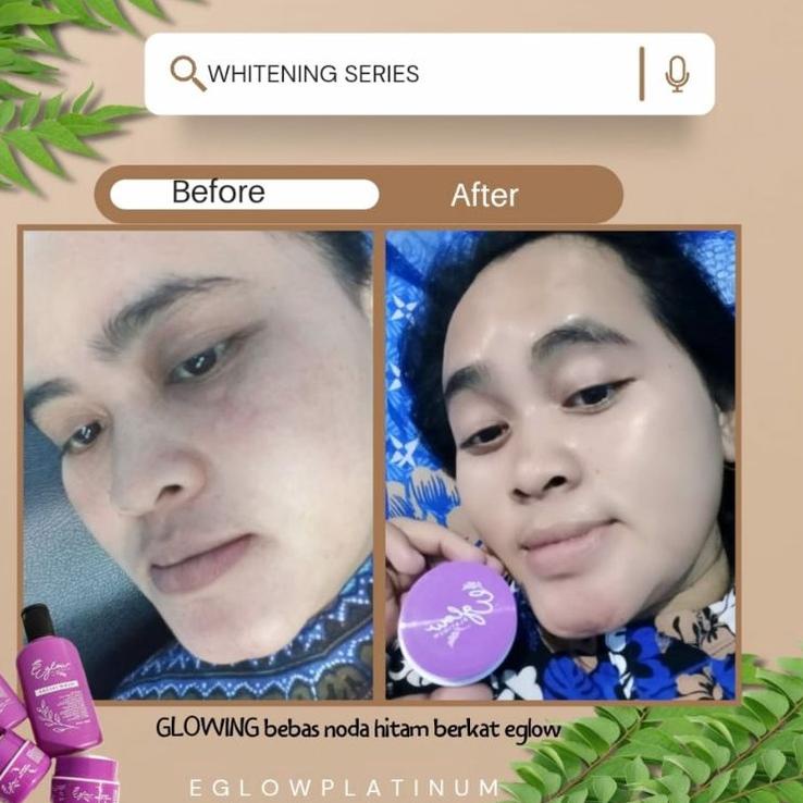 Pkd-557|⭐ Đai Nịt Bụng Và busui Bạch Kim An Toàn Cho Mẹ Bầu⭐Xe tăng | BigBuy360 - bigbuy360.vn