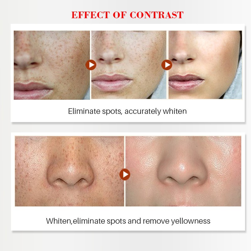  Tinh chất Arbutin dưỡng ẩm làm trắng da chống lão hóa 5ml | BigBuy360 - bigbuy360.vn