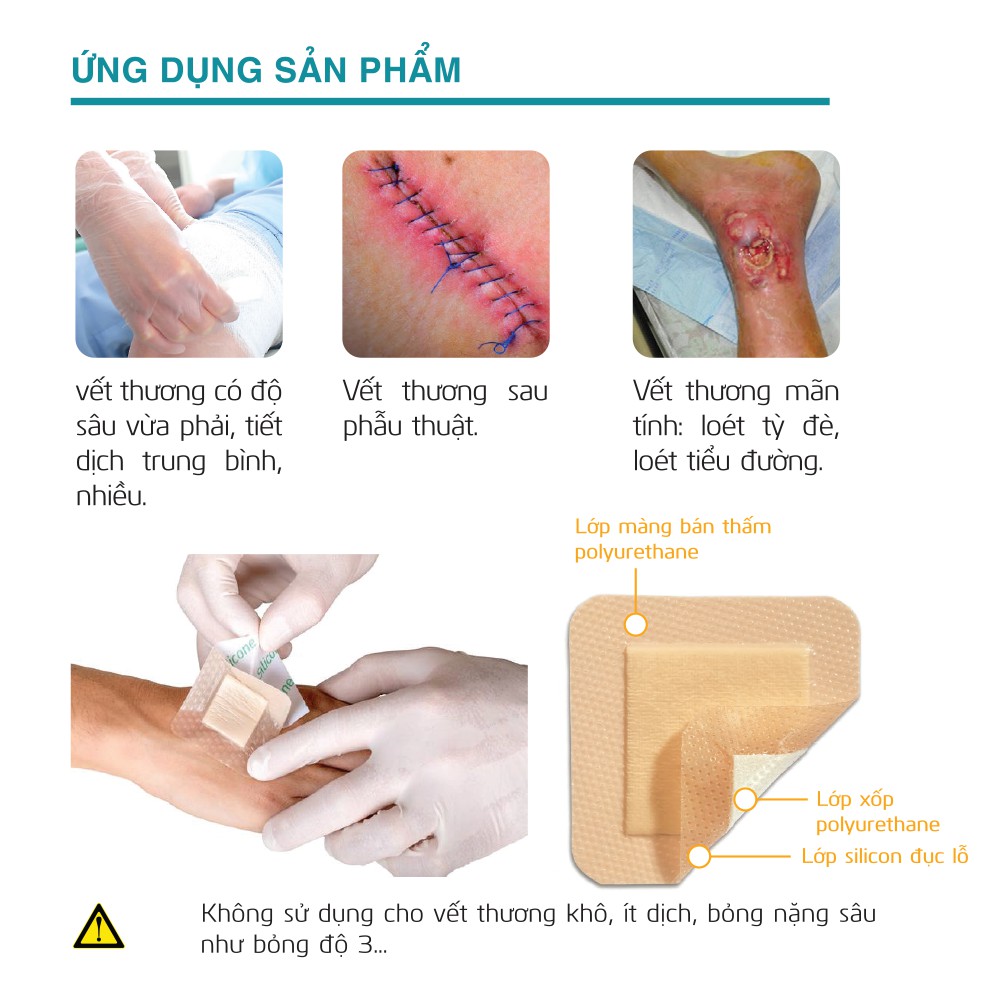 Miếng Gạc xốp Silicone vô trùng HETIS Silicole Foam - Gạc chăm sóc vết thương SPU