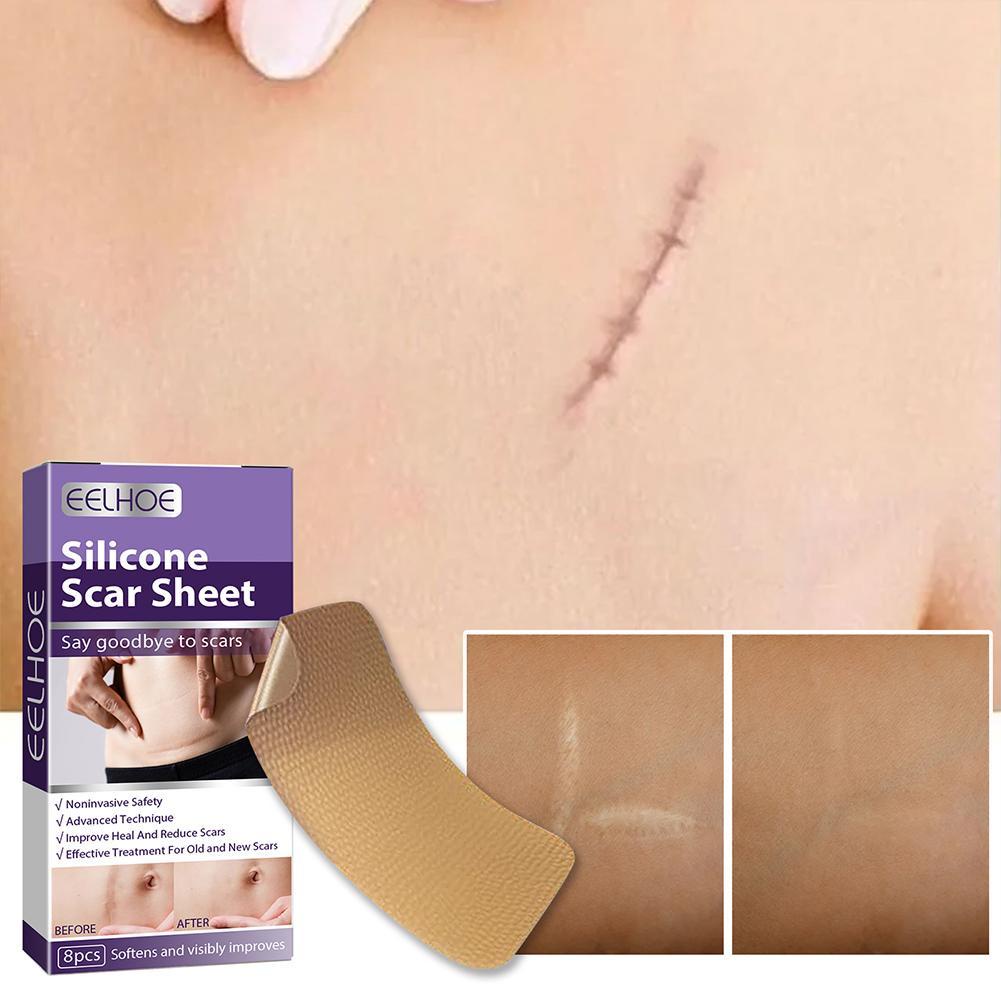 Bộ 8 Miếng Dán Silicone Hỗ trợ giảm sẹo Làm Sáng Tông Màu Da Q2T4