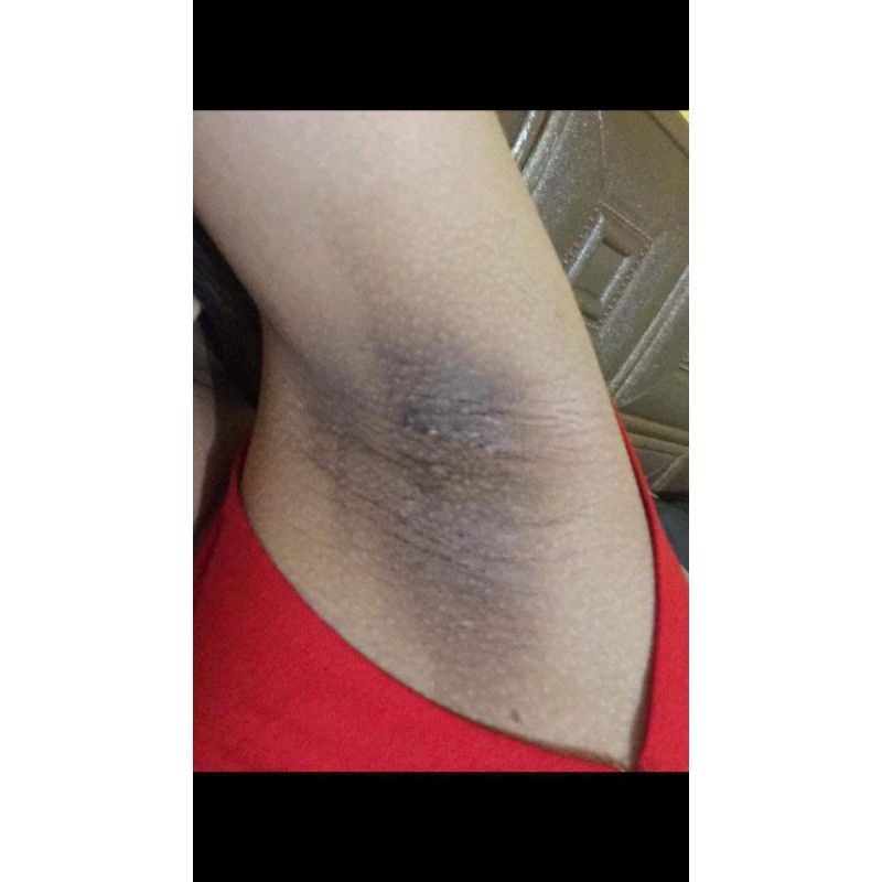 Kem loại bỏ thâm nách hôi nách Cô Bơ hủ nhỏ 8gr | BigBuy360 - bigbuy360.vn