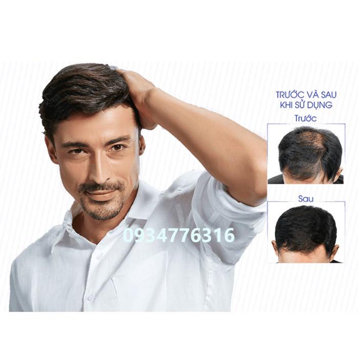 Viên uống QIK HAIR (cho Nam) giảm rụng, mọc tóc chắc khỏe (30 viên)