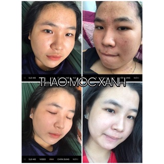 Thảo Mộc Xanh Serum ❗Free Ship