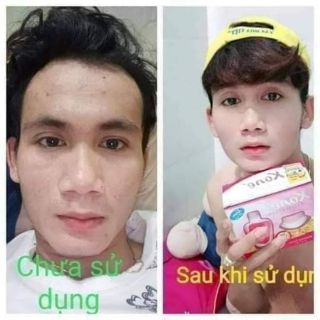 Kem kone thái chính hãng