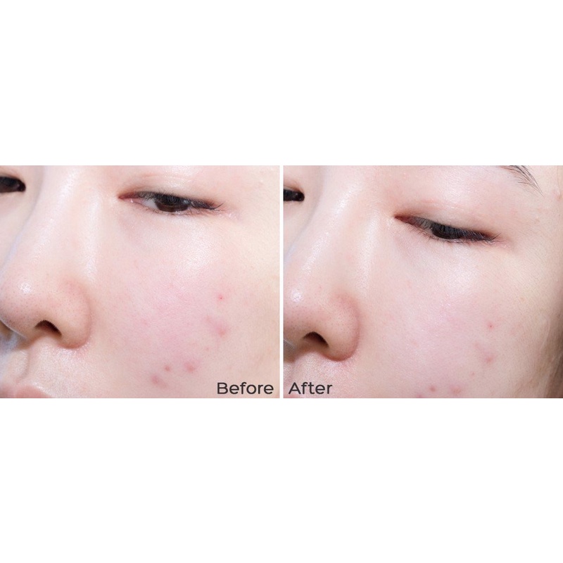 Tinh Chất Vitamin C Giúp Mờ Thâm Nám, Trắng Sáng Dành Cho Da Dễ Kích Ứng Klairs Freshly Juiced Vitamin Drop 35ml