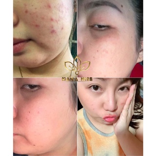 BỘT RỬA MẶT LINH CHI