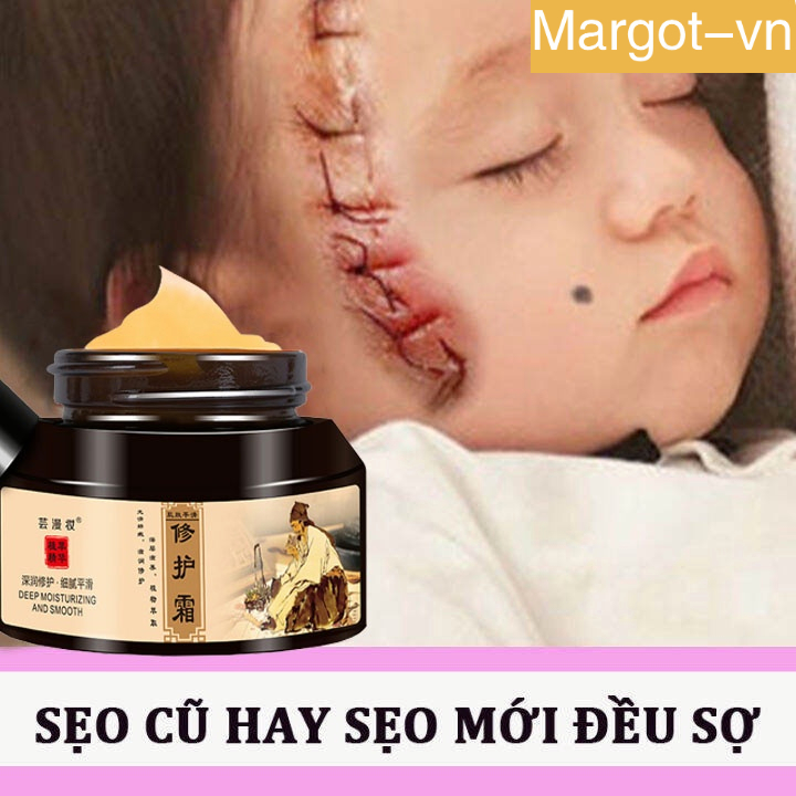 Kem Sẹo Kem xóa Sẹo Thâm Kem trị sẹo 50g Xóa sẹo thâm rạn da hiệu quả mờ thâm bỏng thương phẫu thuật thuốc trị sẹo
