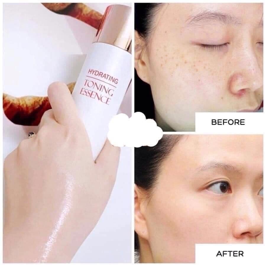 Toner huyết tơ tằm dưỡng trắng Hydrating Toning Essence 150ml căng bóng cho da nám sạm Harin Cosmetic nhập khẩu Hàn Quốc