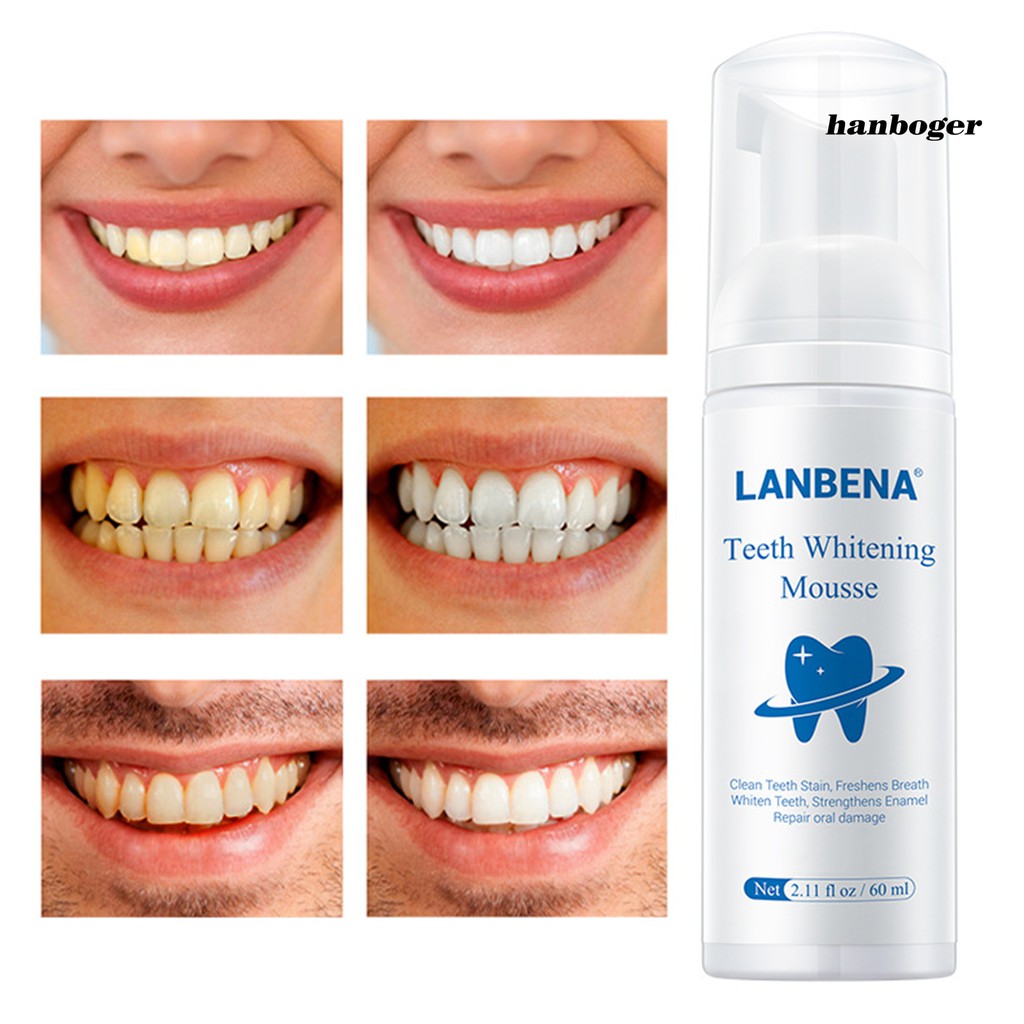 (Hàng Mới Về) Kem Đánh Răng Tạo Bọt Làm Trắng Răng Lanbena
