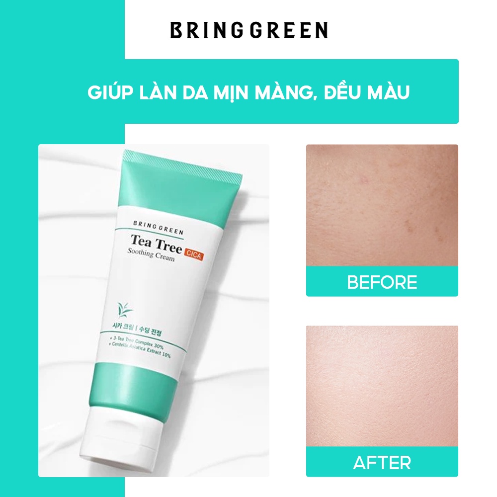 Kem Dưỡng Giảm Mụn Làm Dịu Da Tràm Trà Bring Green Tea Tree Cica Soothing Cream 100ml