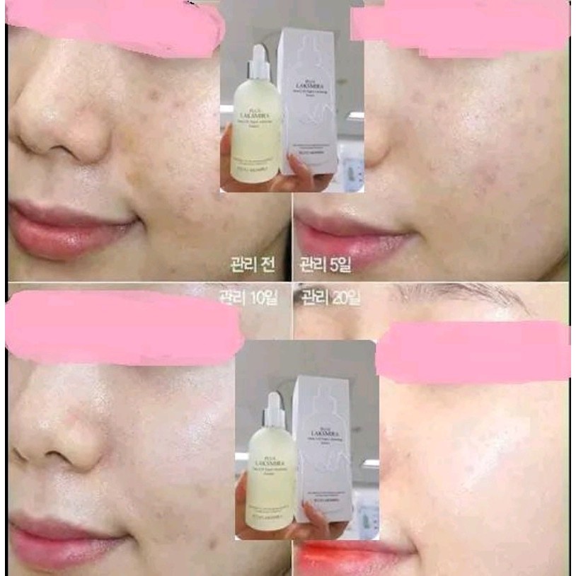 Serum tế bào gốc dưỡng trắng da PLUS LAKSMIRA