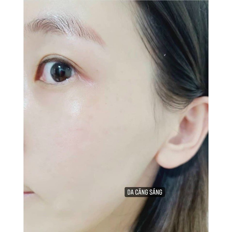 Nước Hoa Hồng  Biomeek 150ml-Cho Da Yếu, Nhạy Cảm, Se Khít Lỗ Chân Lông, Kiềm Dầu