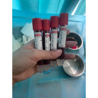 Bộ KIT PRP công nghệ mới.