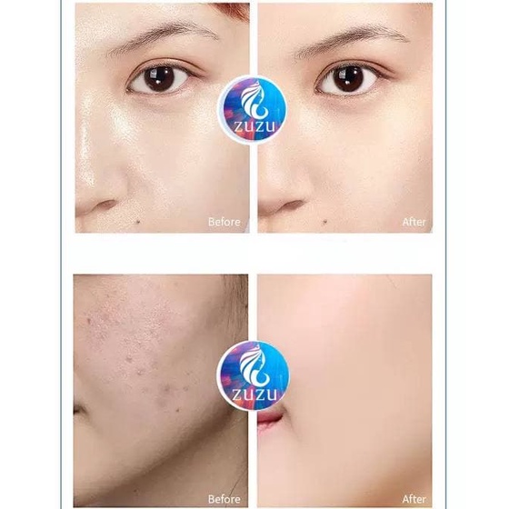 Phấn Phủ Bột Kiềm Dầu SKYVIL , kiềm dầu tối đa với 2 tone màu ZUZU Cosmetic