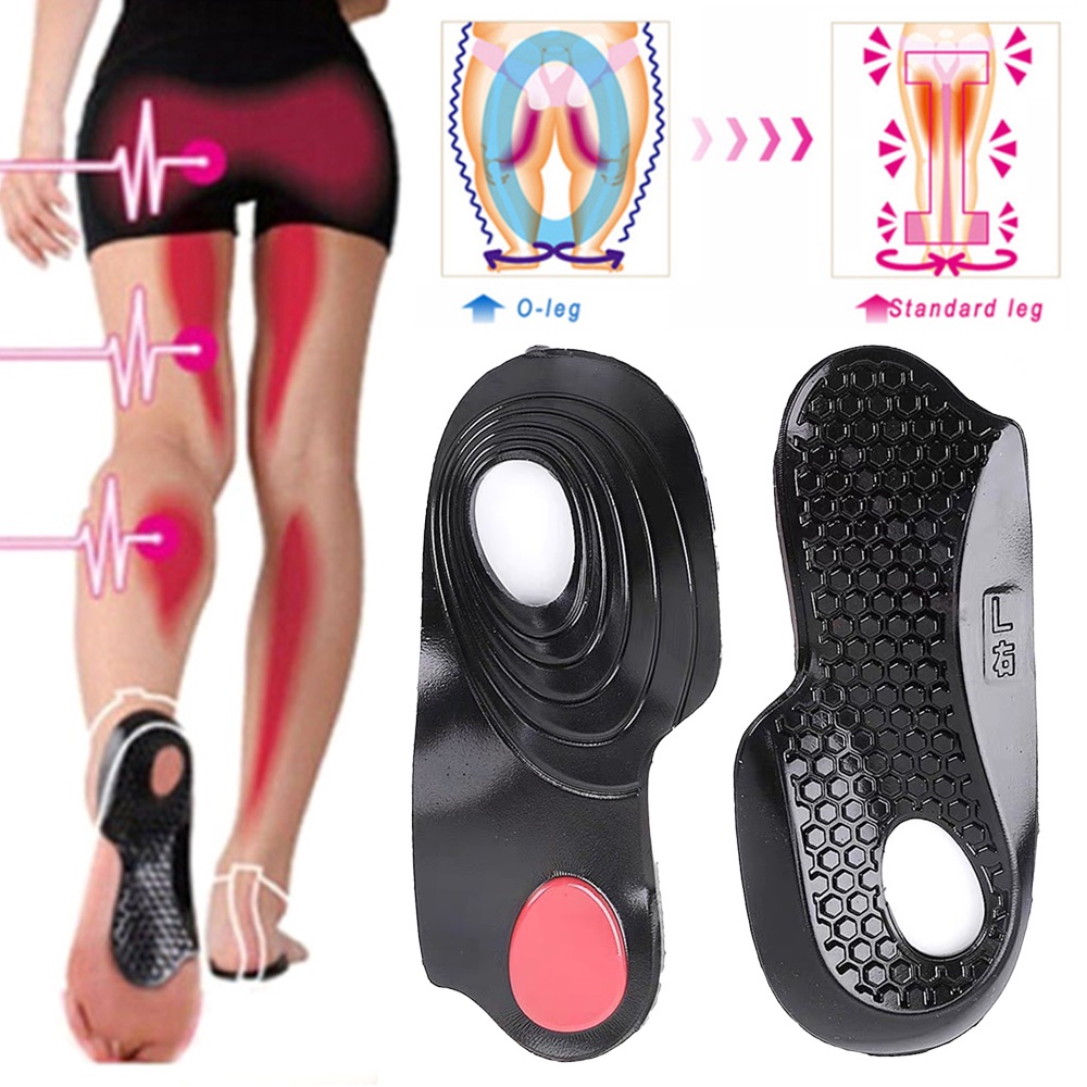 1 Cặp Đế Lót Giày Định Hình Bàn Chân Phẳng Chữ O / X Có 3 Kích Cỡ