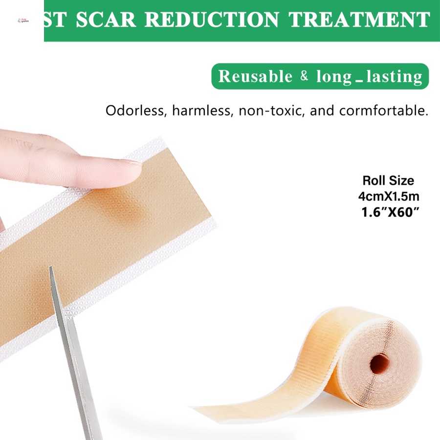 Miếng dán xóa mờ sẹo bằng gel silicone tái sử dụng ALIVER