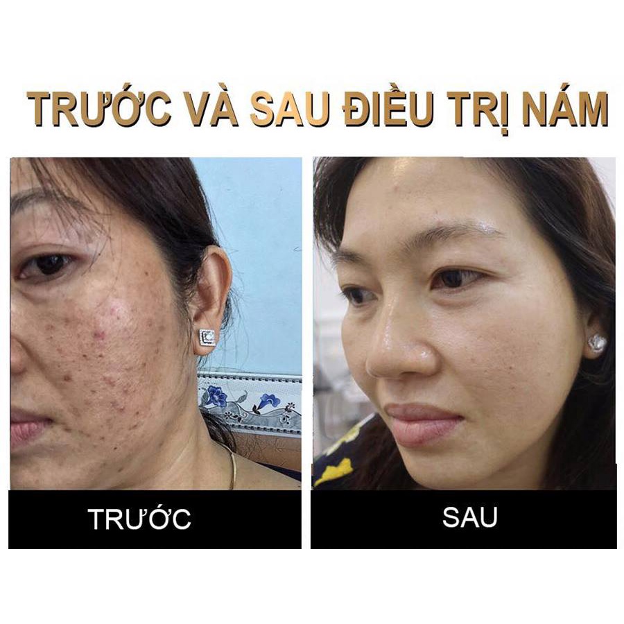 (Tặng kèm bột rửa mặt) Kem đông y tái tạo nhân sâm sạch mụn nám tráng hồng căng bóng