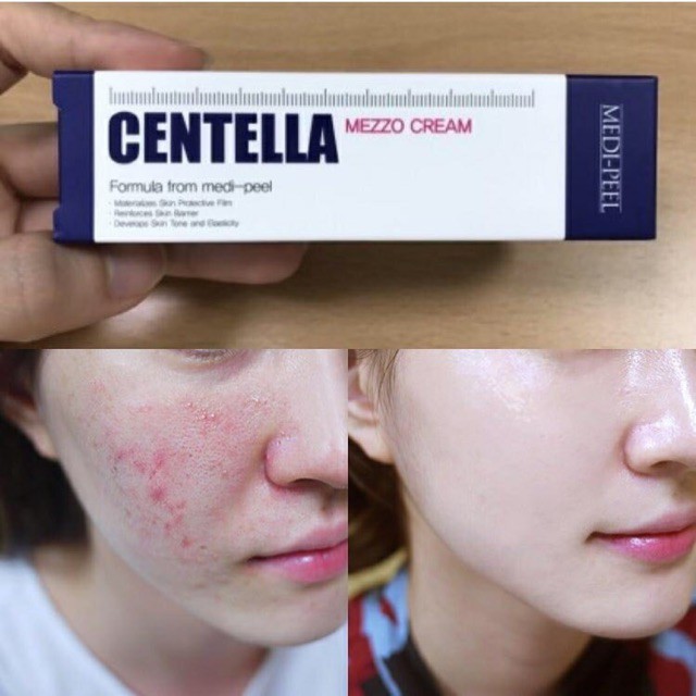 Kem dưỡng da giảm mụn, trắng da Medi Peel Centella Mezzo Cream Hàn Quốc 30ml