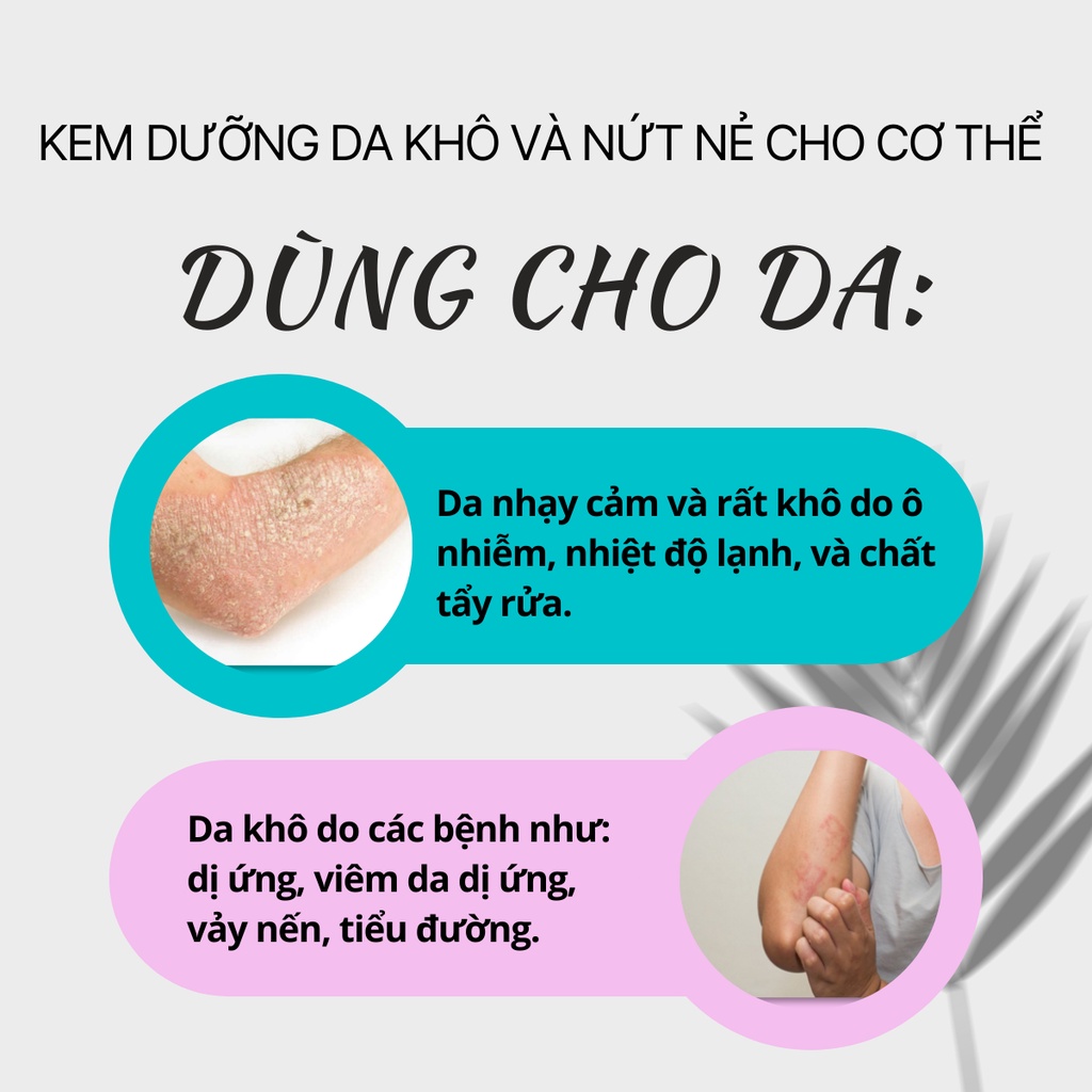 Kem thoa cho da khô Philosoft Moist 24 cung cấp ẩm cho da bị vảy, bong tróc, vảy nến, tiểu đường 100g