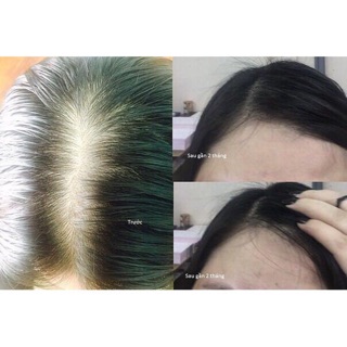 Dầu gội bồ kết thảo dược cô đặc