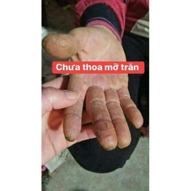 Mỡ Trăn Triệt lông Nguyên Chất N'STORE By Thanh Nhi - Chăm sóc da hiệu quả, NPP GBION | BigBuy360 - bigbuy360.vn