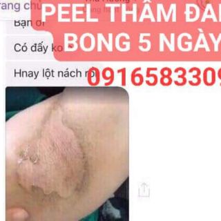 PEEL TCA CHẤM DỨT THÂM NÁCH