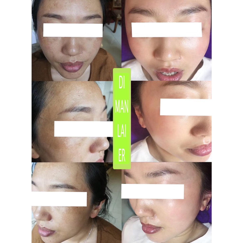 Tinh dầu cam thảo - Tinh dầu Địa Lan dưỡng sáng da