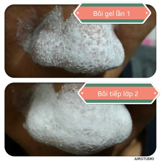 Gel lột mụn  Celona