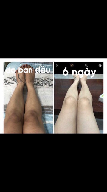 bộ tắm trắng cao cấp châu phi