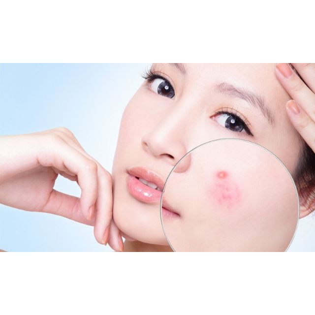 Kem Chấm Mụn Chuyên Biệt La Roche Posay Effaclar A.I. Targeted Breakout Corrector 15ml | BigBuy360 - bigbuy360.vn