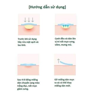 Miếng dán mụn AHA Some by mi
