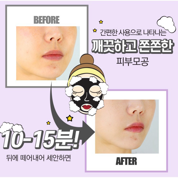 tuan203 Mặt Nạ Sủi Bọt Giúp Loại Bỏ Tế Bào Chết, Mụn Đầu Đen Và Bã Nhờn G9SKIN Self Aesthetic Pore Clean Bubble Mask tua