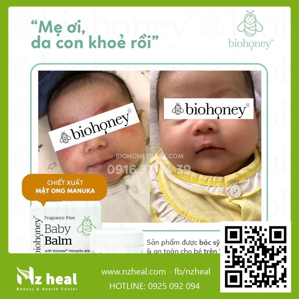 [Hỏa tốc] Kem Biohoney Baby Balm - Hết chàm sữa, viêm da, hăm tã, mẩn ngứa cho trẻ