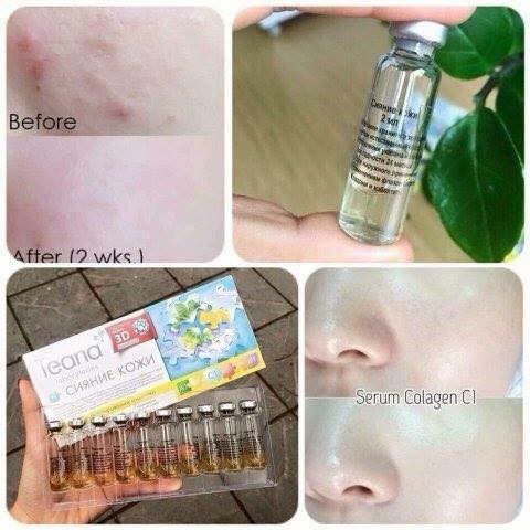 Serum Collagen Teana C1 mịn da, mờ nám, tàn nhang