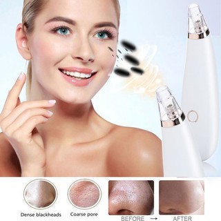 máy hút mụn đầu đen