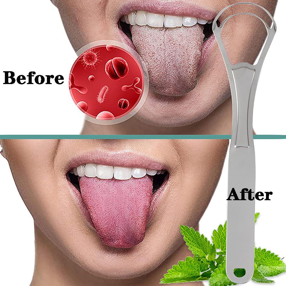 Somedayzl Dụng Cụ Cạo Lưỡi Bằng Thép Không Gỉ Hai Lớp Thoáng Khí Thân Thiện Với Môi Trường Chăm S